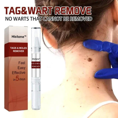 🔥Histone™ Tags & Moles Remover（🔥LAST DAY SALE-85% OFF🔥)