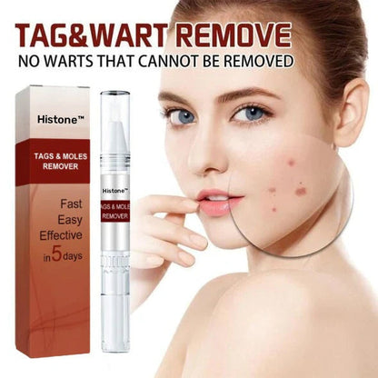 🔥Histone™ Tags & Moles Remover（🔥LAST DAY SALE-85% OFF🔥)