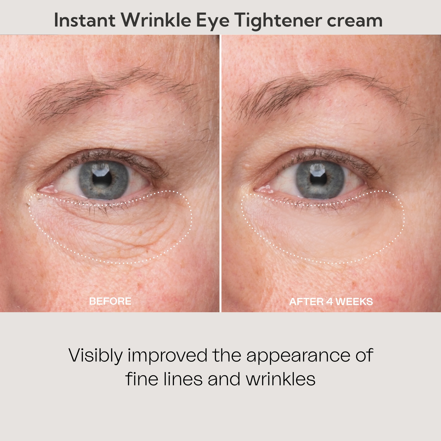 🔥LAST DAY - BUY 1 GET 1 FREE🎉💯🔥Instant Wrinkle Eye Tightener cream