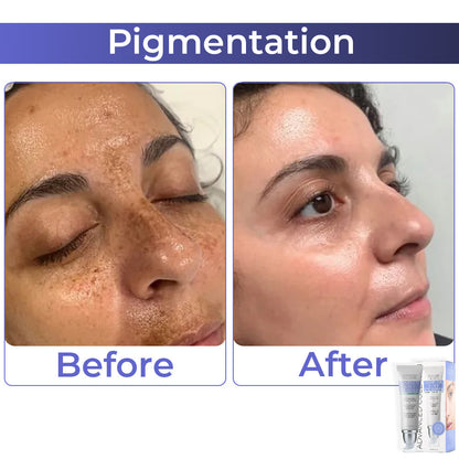 (🔥LAST DAY SALE-80% OFF)🌟 Advanced Collagen Complete Eye Cream