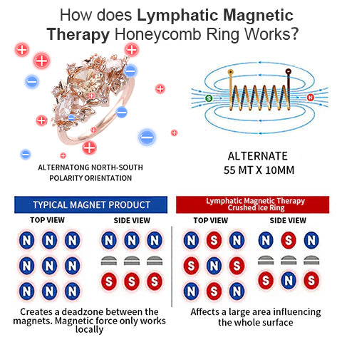 Lymphatic Magnetic Therapy Diamond Ring💖（🔥LAST DAY SALE-80% OFF)