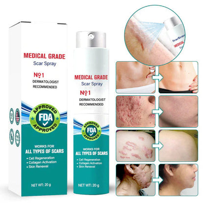 (🔥Last Day Sale-85% OFF🔥)❤️Advanced Scar Spray For All Types of Scars - For example Acne Scars, Surgical Scars and Stretch Marks