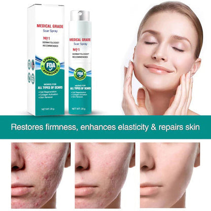 (🔥Last Day Sale-85% OFF🔥)❤️Advanced Scar Spray For All Types of Scars - For example Acne Scars, Surgical Scars and Stretch Marks