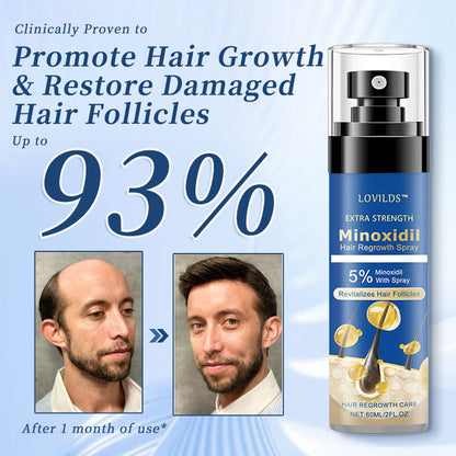 💥 𝑳𝒊𝒎𝒊𝒕𝒆𝒅-𝑻𝒊𝒎𝒆 𝑫𝒊𝒔𝒄𝒐𝒖𝒏𝒕 𝑶𝒇𝒇𝒆𝒓𝒔! 🔥Minoxidil Hair Regrowth Spray